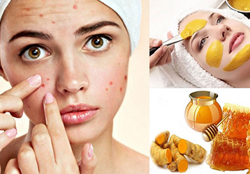 Tại sao cần phục hồi da sau mụn là cần thiết?
